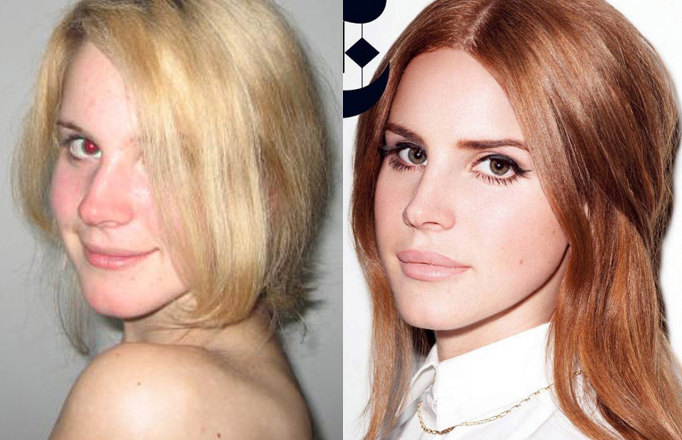 Lana del rey до и после пластики Lana del rey до и после пластики