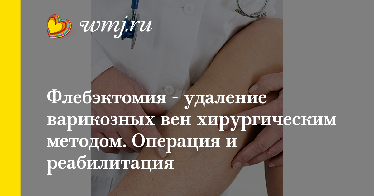 Эфирные масла от варикоза