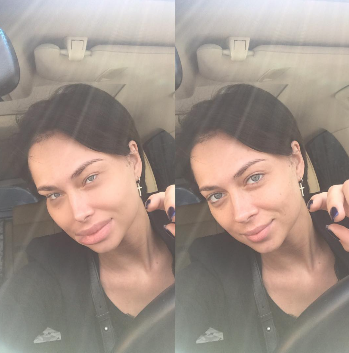 Самбурская настасья до. Самбурская до и после пластики. Настасья самбурская до и после. Самбурская настасья до пластики. Самбурская настасья пластические операции.