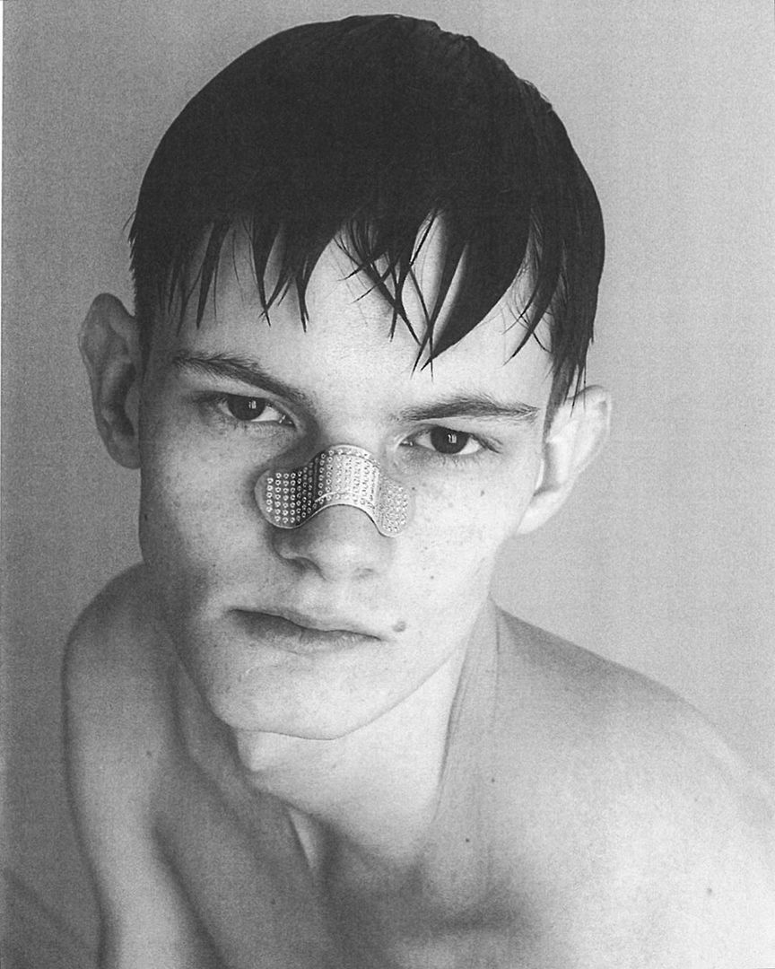 пластырь на переносице