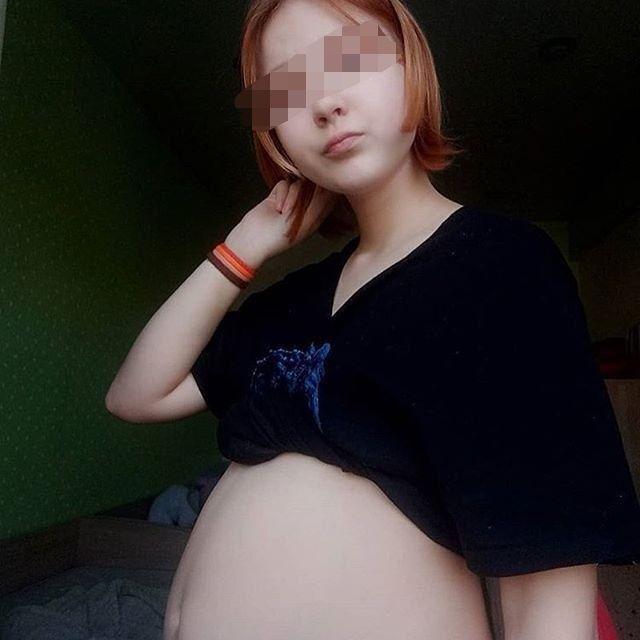 13-летняя беременная россиянка показала необычно большой живот и результатУЗИ