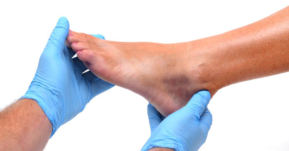 Шишки на ногах современное лечение thumbnail