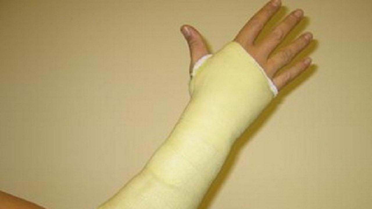 Купить Пластиковый Гипс Для Руки В Ижевске