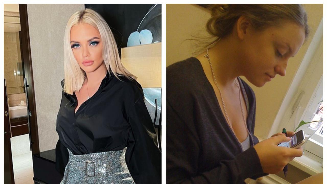 Милана тюльпанова фото до и после операции