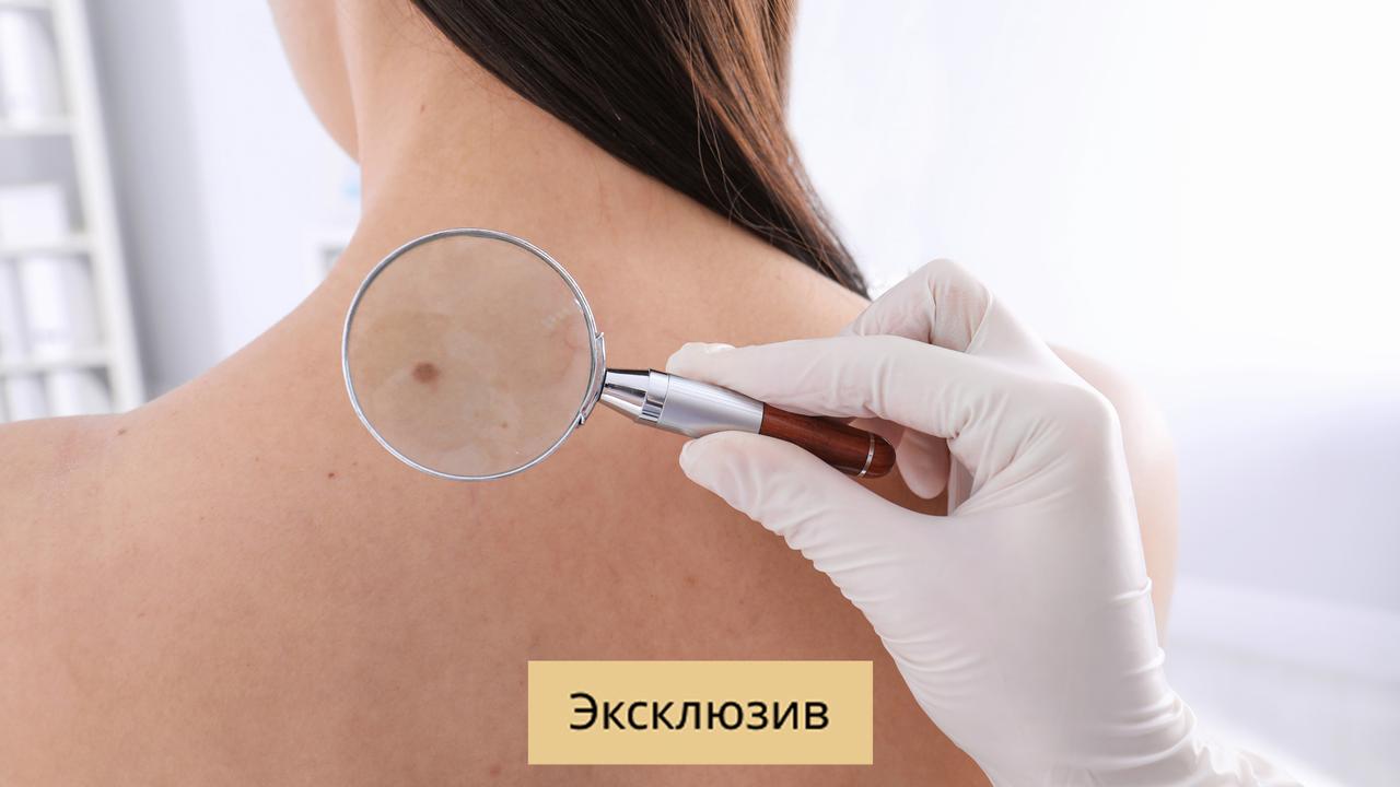 Осмотрен дерматовенерологом. В настоящее время