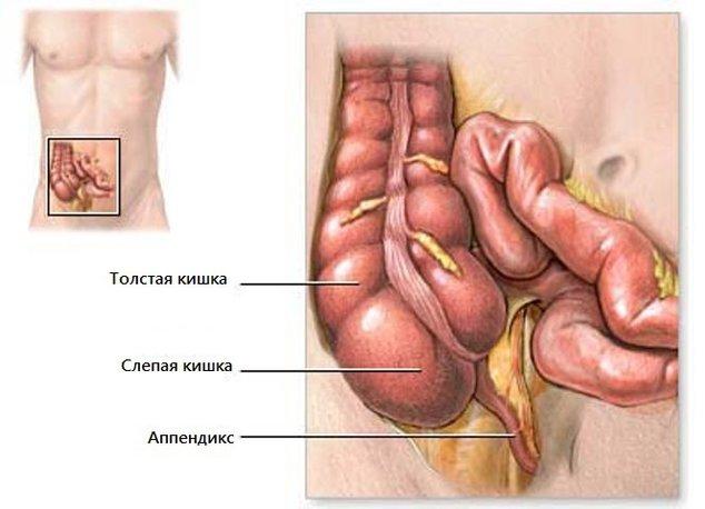 Фото Аппендикса Человека